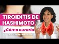 Tiroiditis de Hashimoto: como curar o revertir el hipotiroidismo con alimentación y suplementos