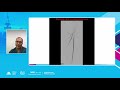 BTK Interventions  Access how to do and Principle - Rami Tadros, MD