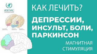 Магнитная стимуляция, Депрессия, Болезнь Паркинсона, Инсульт, Боли