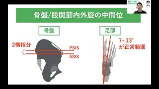 股関節5−④梨状筋症候群　治療アプローチ