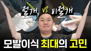 탈모가 있다면 한번쯤은 하는 고민! | 모발이식 절개vs비절개