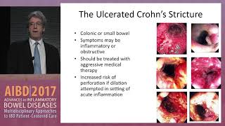 How to access and determine the severity and complications of small bowel Crohn’s disease