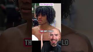 Pre Surgery Michael Jackson Michaeljackson Plasticsurgery