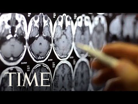 How is cognitive function affected by aging?