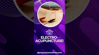 Electroacupuncture! #electroacupuncture #bodypainrelief #painrelief #physicaltherapy