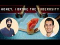 How To Manage a Maxillary Tuberosity Fracture - Oral Surgery Complications