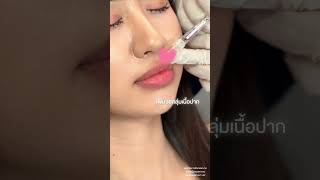 ปากฉ่ำๆพร้อมเสริฟแล้วจ้าาา💋✨#cosmoclinicbkk #หัตถการ #ฟิลเลอร์ปาก #lipsfiller #สายฝอ #สายเกา