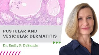 Pustular and Vesicular Dermatitis Part 1 / November 2024 \\ Dermpath with Davis & DeSantis