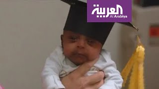 الطفلة التفاحة.. طفلة ولدت بوزن ربع كيلوغرام وعاشت