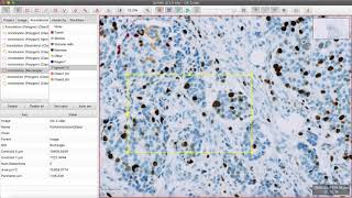 Pixel Classification using QuPath