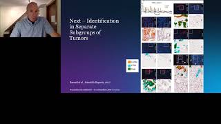 Detection and Treatment Prediction of Pancreatic Cancer Using a Glycan Biomarker​