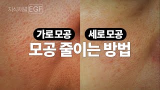 가로, 세로 모공 줄이는 확실한 방법