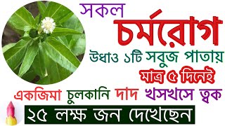 দাদ, একজিমা ও চুলকানি সারবে স্থায়ীভাবে | ECZEMA TREATMENT AT HOME IN BANGLA | ECZEMA HOME REMEDY