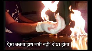 | ऐसा जलता हाथ कभी नहीं देखा होगा | - Burning Hand never seen before.