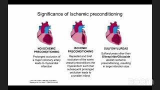 Dược lý lâm sàng Sulfolurea: Glipizide, Gliclazide, Glimepiride