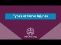 Types of Nerve Injuries