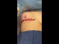 ftm double incision nipple sensation preserving surgery