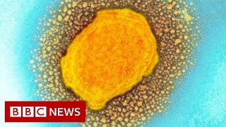 How to spot symptoms of monkeypox - BBC News