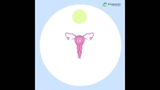 IVF Process Step-by-step animation.