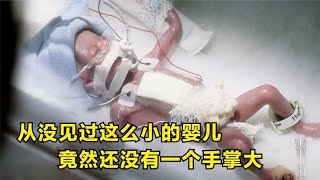 从没见过这么小的婴儿，竟然还没有一个手掌大【影视】