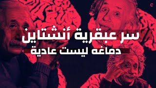 ماهو سر عبقرية أنشتاين ؟ وماذا وجد العلماء عند تشريح دماغه ؟