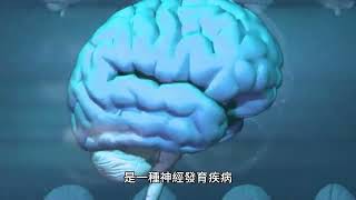 亞斯伯格症（AS），也稱為亞斯伯格症，是一種神經發育疾病，其特徵是社交互動和非語言交流存在嚴重困難，行為和興趣模式受到限制和重複