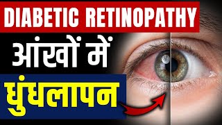 Diabetic Retinopathy Can cause blindness || Axico Ayurveda