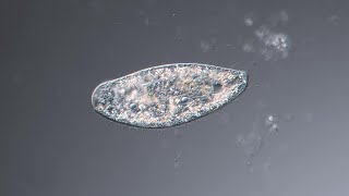 The unfortunate demise of a ciliate - Loxodes