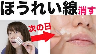 ほうれい線を消す！貼る美容液を試してみた結果！【整形級】