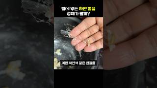 쌀밥 하얀껍질 정체가 뭘까?