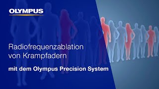 Krampfadern schonend und sicher behandeln - Precision System | OLYMPUS