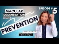 What are the prevention strategies for Macular Degeneration?