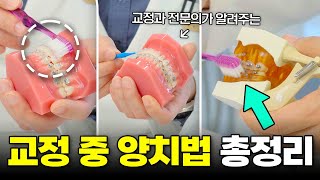 교정과 전문의가 알려주는 치아교정 중 양치질 방법 l 교정중 양치질은 이 순서대로 해주세요!