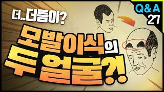 [모빈치TV] 모발이식의 두 얼굴?! 더듬이..?!