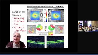 Identification \u0026 Management of progression in Glaucoma | Dr. Ramanjit Sihota | Glaucoma Session |