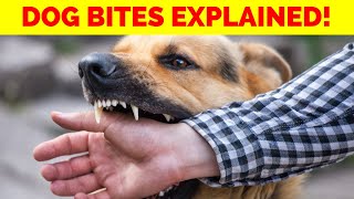 Why Dogs Bite? 12 Causes You Need to Know!