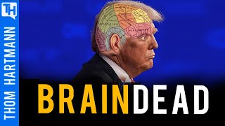 Was Deranged Press Conference Proof Trump is Brain Dead?