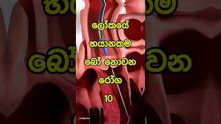 ලෝකයේ භයානකම බෝ නොවන රෝග 10 | most dangerous noncommunicable diseases |😇😱| #shorts #top10 #viral