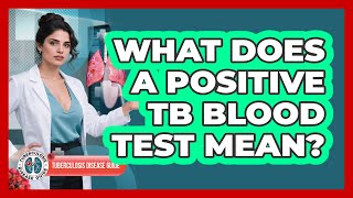 What Does a Positive TB Blood Test Mean?