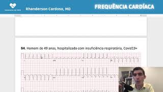 Aula 6 (prática): Como calcular a frequência cardíaca no ECG?