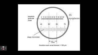 2.1.1. Cell structure b) The use of an eyepiece graticule and stage micrometer.