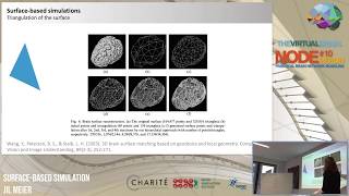 TVB Node 10: Surface-based simulations and deep brain stimulations by Jil Meier