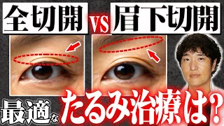 全切開と眉下切開、目の開きを改善させるならどっち？　○○は間違うと危険です...【二重全切開、瞼のたるみ】