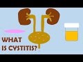 What is Cystitis?