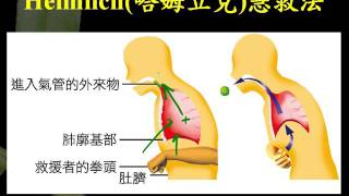 基礎生物3 3 04哈姆力克急救法一博