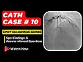 Case 10: Cath Spot Diagnosis Case Series - Interventional Cardiology