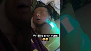 Jaundice | Our Little Glow Worm 💚 #newborn #baby #story #throwback