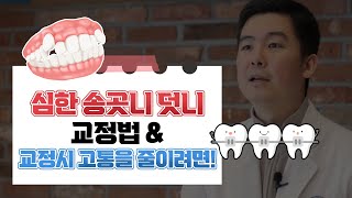 송곳니가 심할 때는? 그리고 안 아프게 교정하려면?