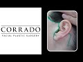 Performing Facelift Surgery Without Visible Scars | Dr. Anthony Corrado