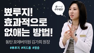 흉터 안남게 제거하는 뾰루지! 손으로 짜도 되나? 원인 | 흉터 | 여드름 | 염증 | 치료